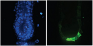 R1091P - GFP