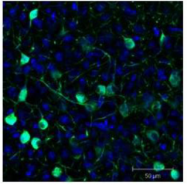 R1091P - GFP