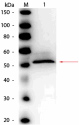 R1093HRPS - Hexokinase
