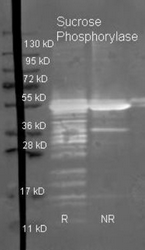 R1150PS - Sucrose phosphorylase