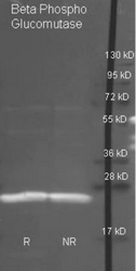 R1157PS - PGMB