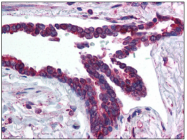 R1575P - HIF3A / HIF3 alpha