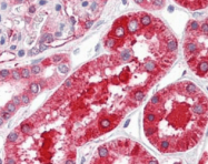 R1596 - Ferritin