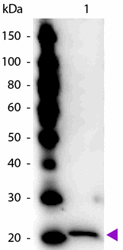 R1596PS - Ferritin