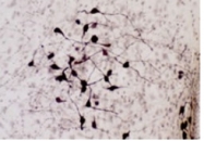 RA24604-100 - Oxytocin