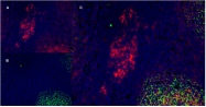 SM1102P - CD40