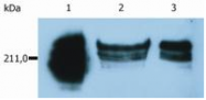 SM1115PP - CD45 / LCA