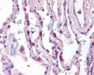 SM1182AS - CD88 / C5R1