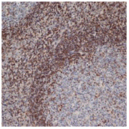 SM1414P - Bcl-2