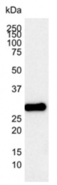 SM1414P - Bcl-2