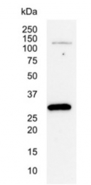 SM1421P - PCNA