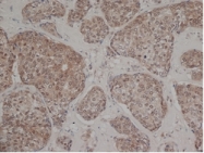 SM1682 - Estrogen receptor beta