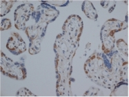 SM1682 - Estrogen receptor beta