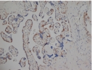 SM1682 - Estrogen receptor beta