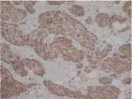 SM1682X - Estrogen receptor beta
