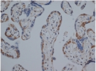 SM1682X - Estrogen receptor beta