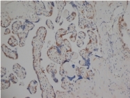 SM1682X - Estrogen receptor beta