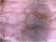 SM1729P - CD91 / LRP1