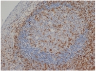 SM1754P - CD3