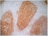 SM1785P - CD21