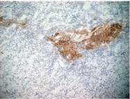 SM1785P - CD21