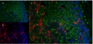 SM1857P - CD206 / MRC1