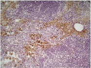 SM1857P - CD206 / MRC1