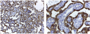 SM2222P - Aromatase