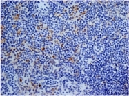 SM2298P - CD13