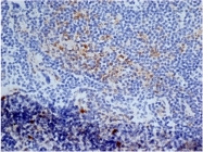 SM2298P - CD13