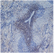 SM255P - CD4