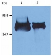 SM3000B - Albumin