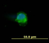 SM3025APC - CD45 / LCA