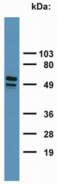 SM3046P - Cytokeratin 7