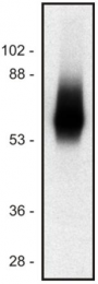 SM3077P - TRAT1 / TRIM