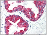SM3079P - Cytokeratin 8