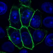 SM3132F - TNFRSF21 / Death receptor 6 (DR6)
