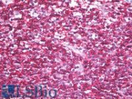 SM3154P - CD45 / LCA