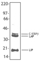SM5053BT - CEBPB