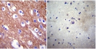 SM5057P - ATP2B4 / PMCA4
