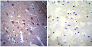 SM5150 - DPYSL5 / CRMP5