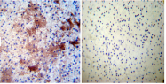 SM5150 - DPYSL5 / CRMP5