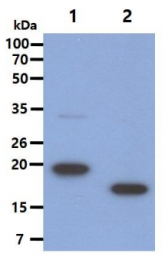SM6016 - Somatotropin / Growth Hormone / GH1