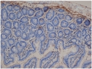 SP2041HRP - Rabbit IgG