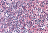 SP4116P - CD312 / EMR2
