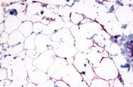 SP4277P - Nicotinic acid receptor 2