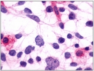 SP4465P - PTGFR