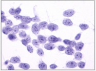 SP4465P - PTGFR