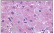 SP4465P - PTGFR