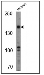 SP5116P - NOS1